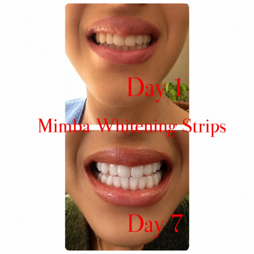 Real customer whitening result