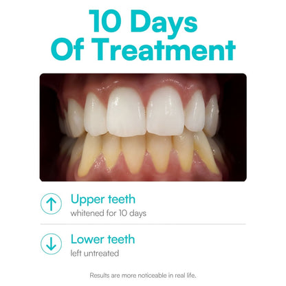 Mimba 6% Teeth Whitening Strips - USA-developed formulation 🇺🇸