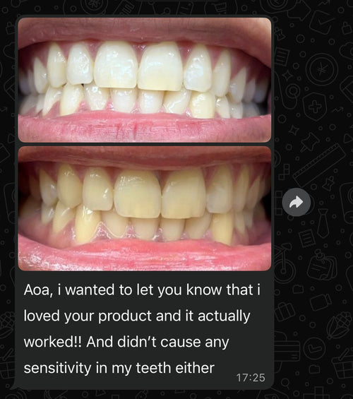 Real customer whitening result