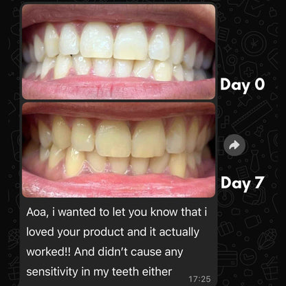 Mimba 6% Teeth Whitening Strips - USA-developed formulation 🇺🇸